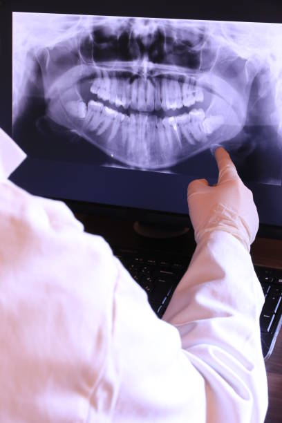 Best Emergency Broken Tooth Repair in Gwinn, MI