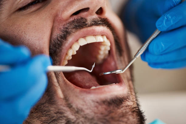 Best Emergency Treatment for Toothache in Gwinn, MI