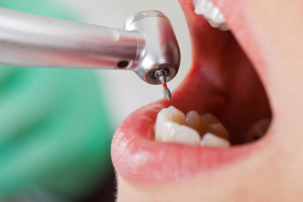 Best After-Hours Emergency Dentist in Gwinn, MI